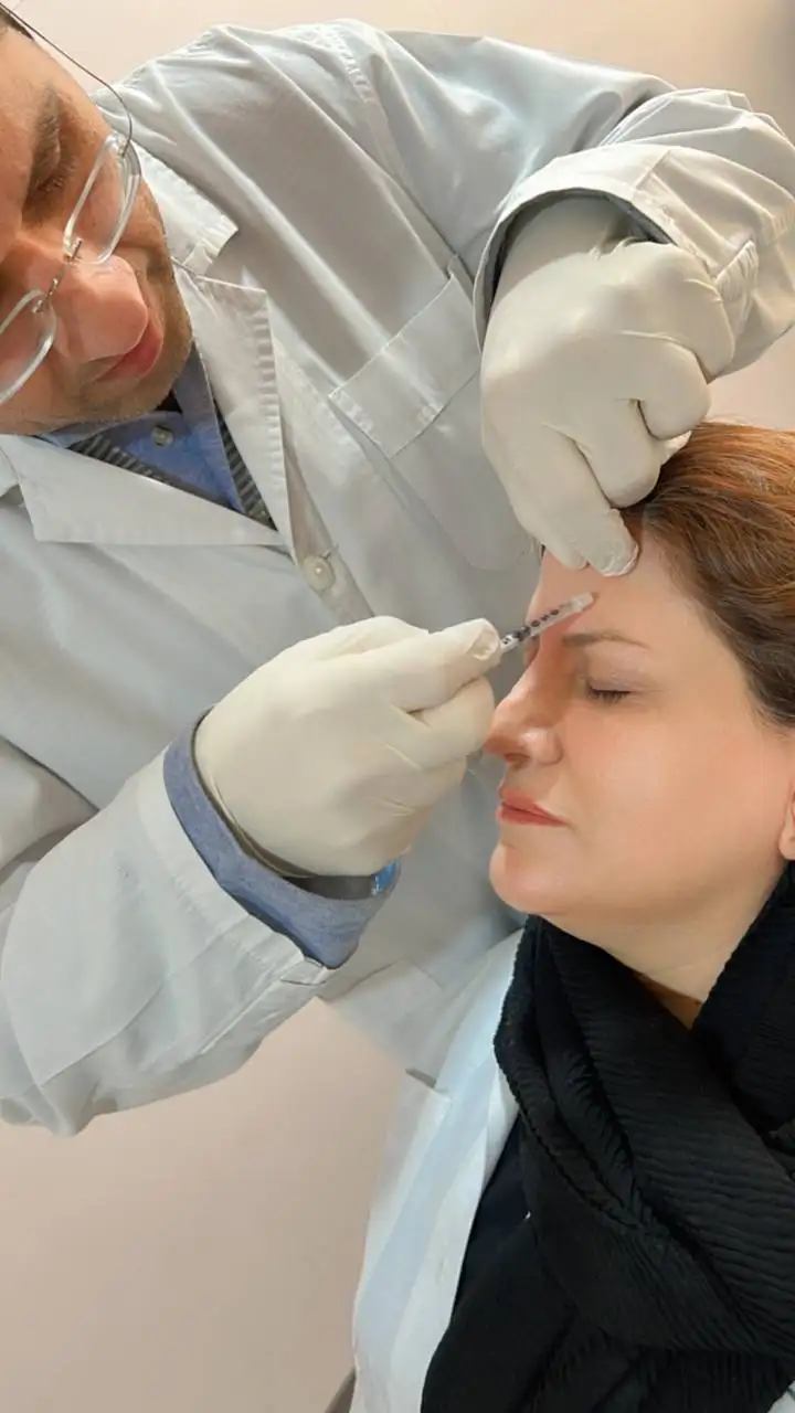 انواع فیلر(ژل)