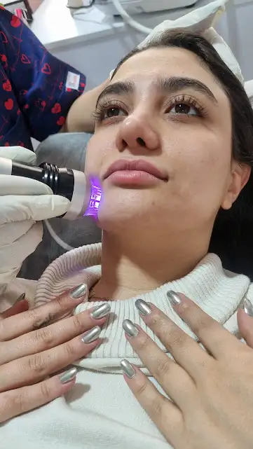 آر اف فرکشنال