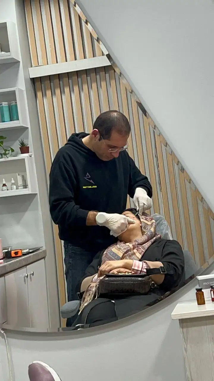 درمان اسکار آکنه