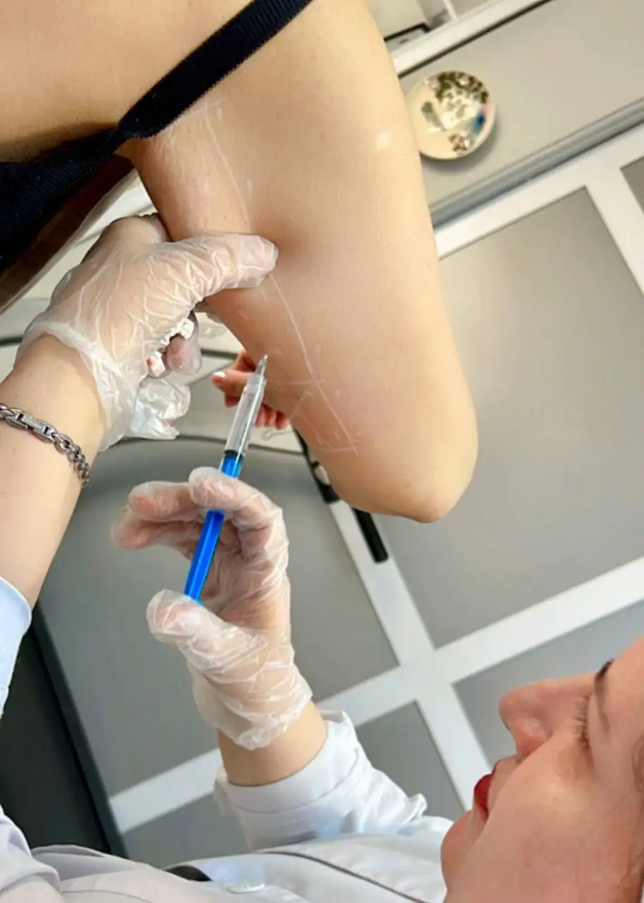 مزوتراپی لاغری