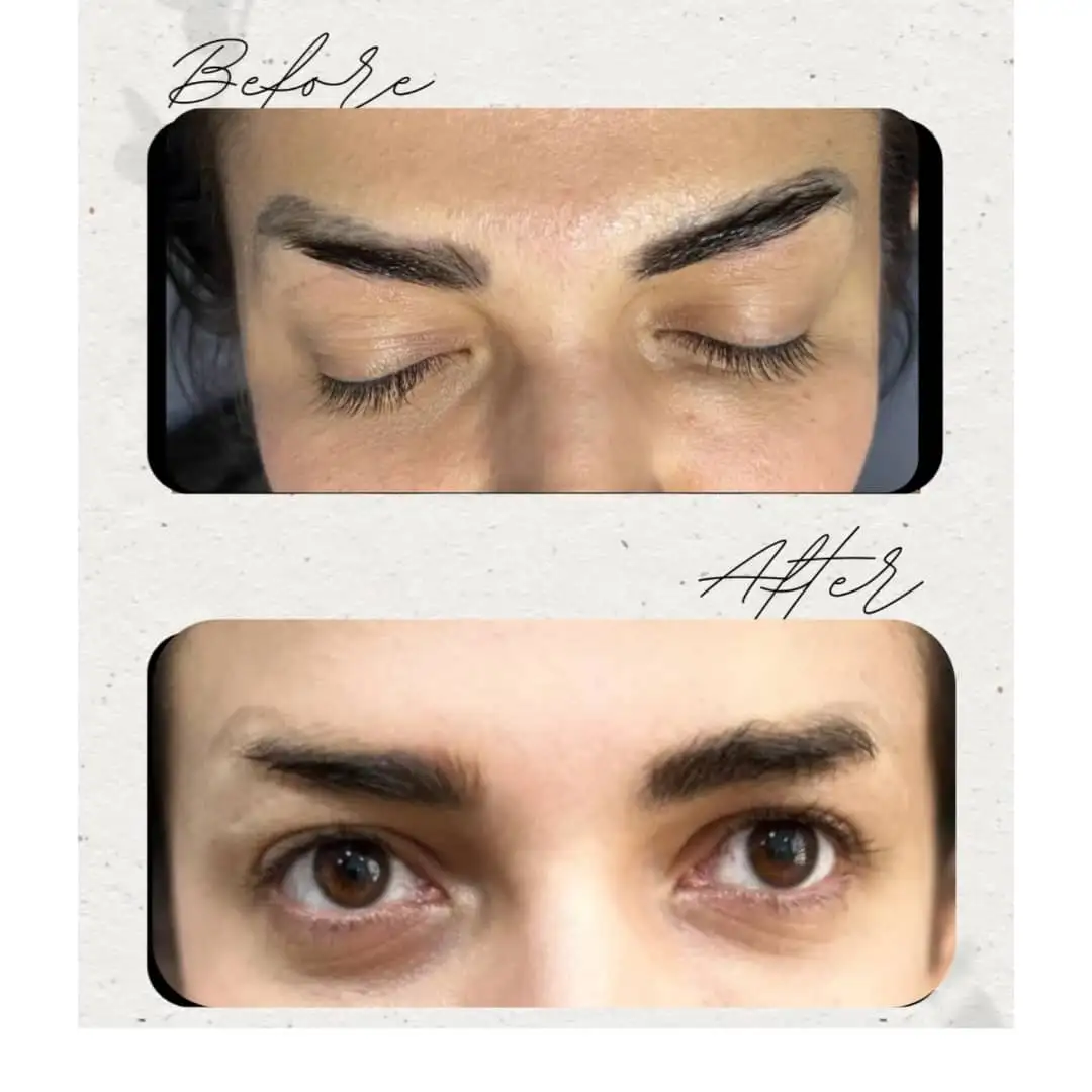 لیزر کیوسوییچ و هالیوودی