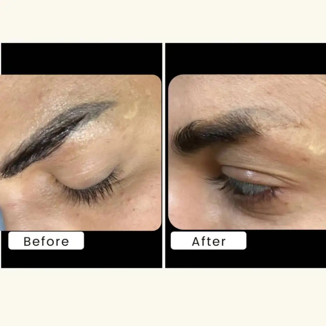 لیزر کیوسوییچ و هالیوودی