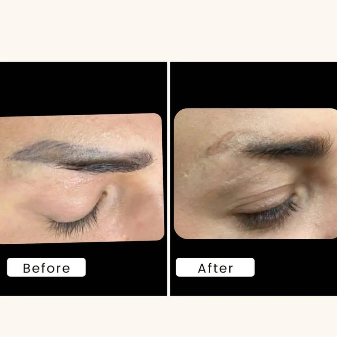 لیزر کیوسوییچ و هالیوودی