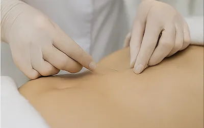 امبدینگ لاغری، فرم‌دهی بدن با نخ‌های قابل جذب