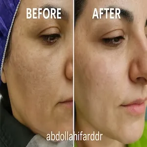 گالری تصاویر