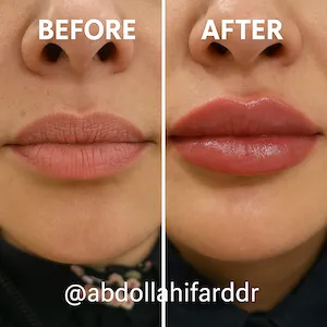 گالری تصاویر